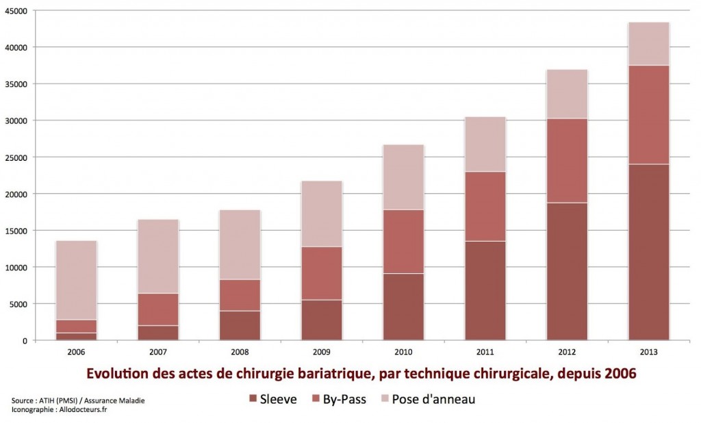 graph 1 chirurgie bariatrique